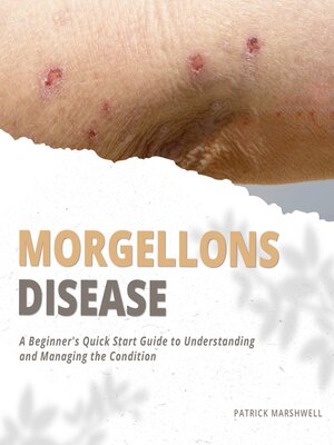 cover image of Morgellons Disease